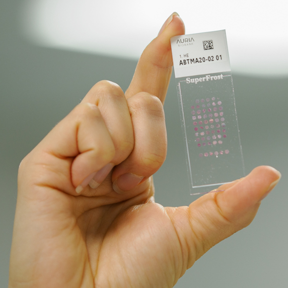 A multi-tissue block in a woman's hand (TMA, tissue microarray).